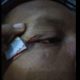 Foto yang diposting di media sosial Facebook, tampak luka robek pada bagian atas mata korban. (ist)