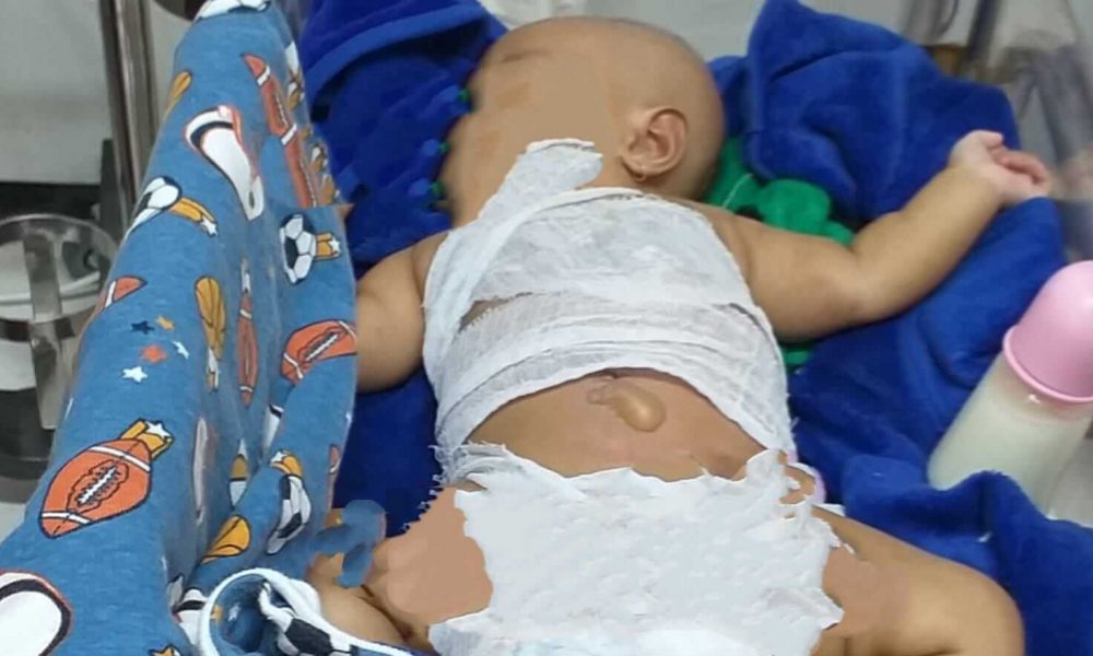 Bayi di Lumajang Dilarikan ke RS, Diduga Dianiaya Orang Tua dan Ada Bekas Sulutan Api Rokok